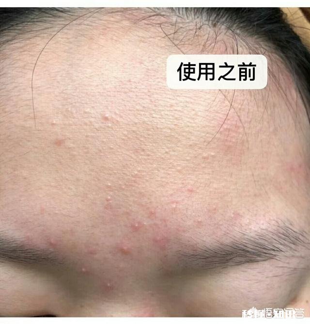 十八岁软妹，干性敏感肌，有什么适合的护肤品推荐