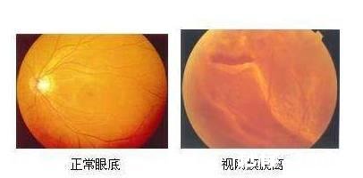 伴随手机电脑的普及，近视的人越来越多，然而近视的人不带眼镜看世界是什么样的