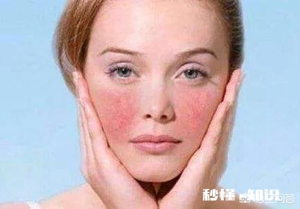 对于敏感肌肤，大家用什么护肤品进行修护的呢