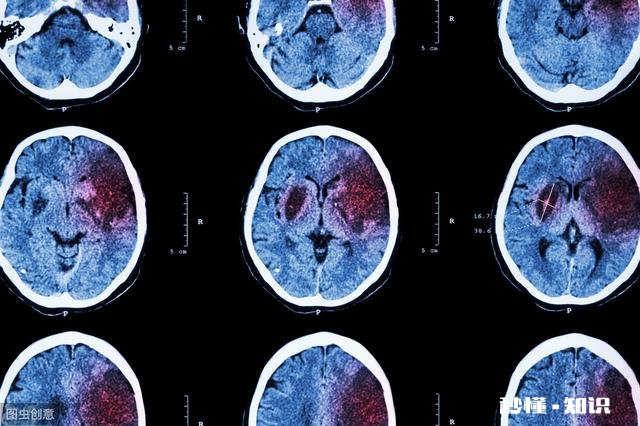 哪些原因会导致中风脑溢血