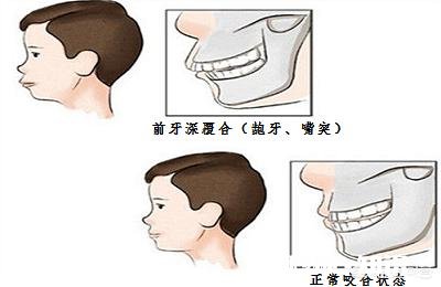 女人有时咬嘴唇是什么心理