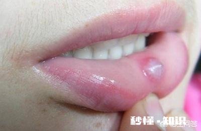 女人有时咬嘴唇是什么心理