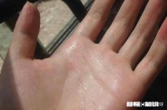 手总是出汗是怎么回事