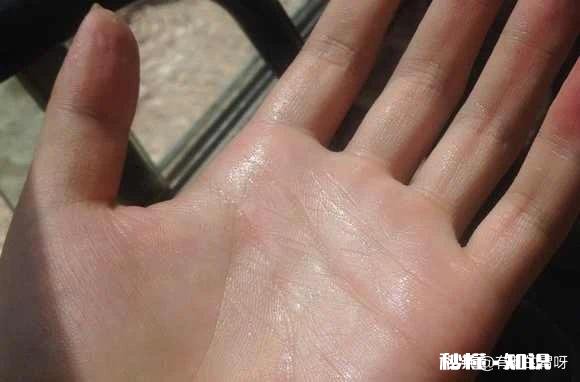 手总是出汗是怎么回事
