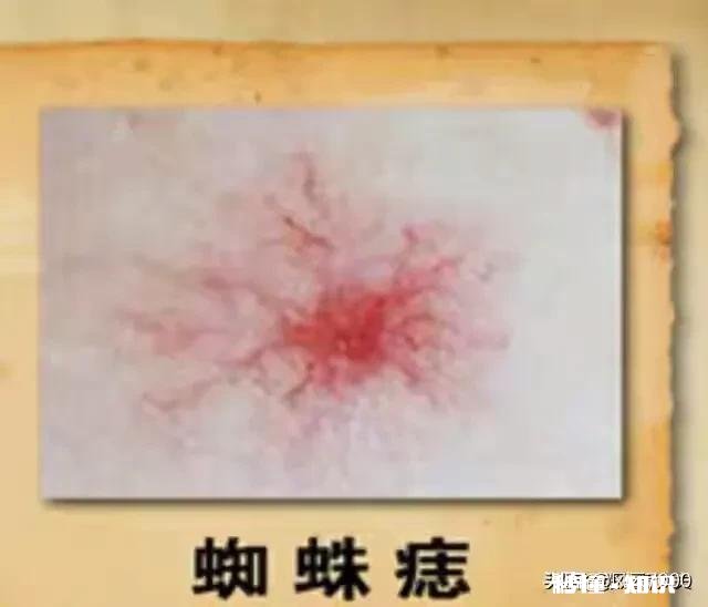 经常喝酒的人，酒后会有哪几种变化，该逼自己戒酒了