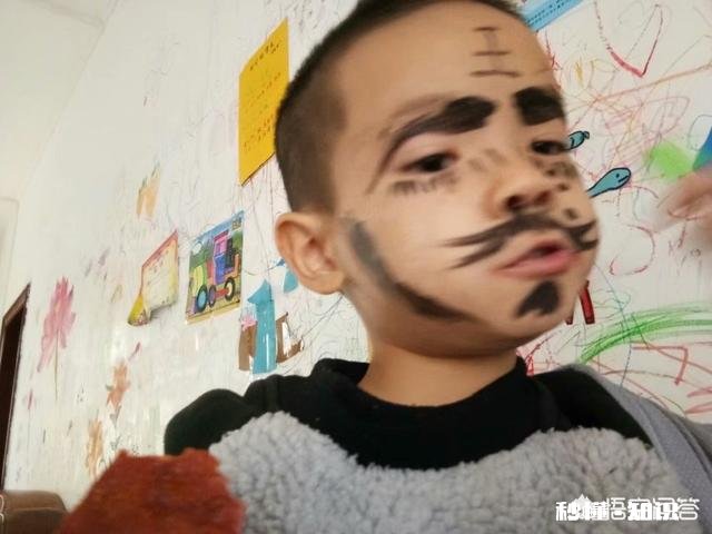 大人手肘部碰到孩子的头，三天过去没事，后面还会有问题吗