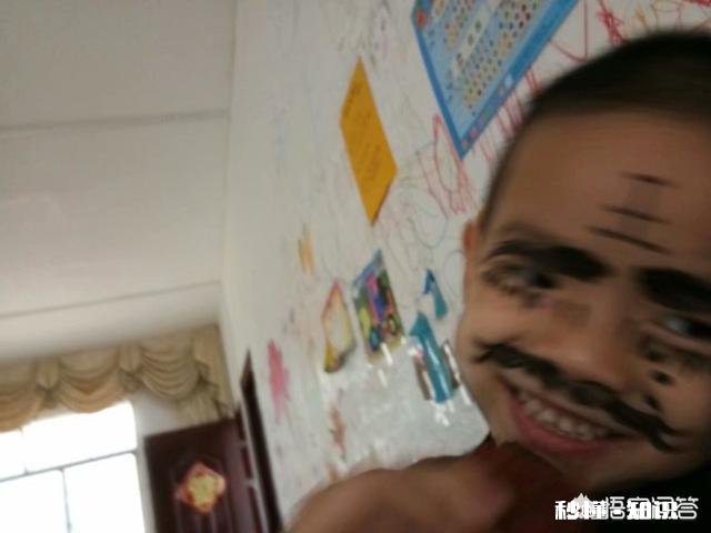 大人手肘部碰到孩子的头，三天过去没事，后面还会有问题吗