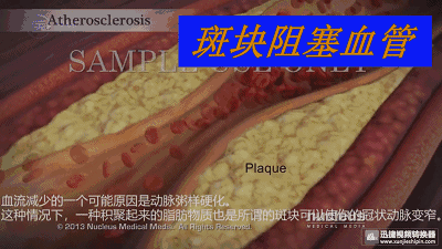 血脂高跟高血脂是一样吗