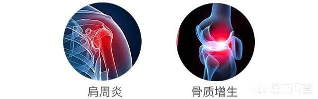 氨糖软骨素可以长期吃吗有什么作用呢