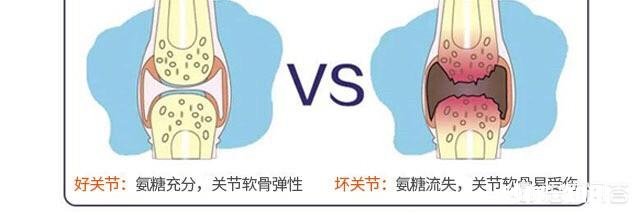 氨糖软骨素可以长期吃吗有什么作用呢