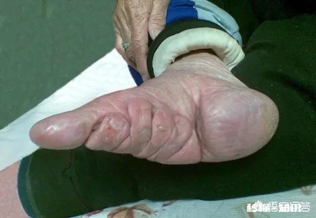 下的令 中国什么朝代皇帝下令幼小的女童裹脚在什么情况下