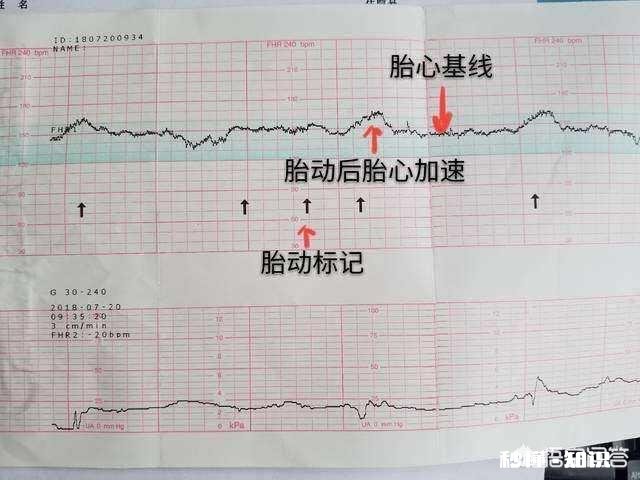 怀孕生男孩，胎心率是每分钟多少下怀孕时应注意什么