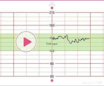 怀孕生男孩，胎心率是每分钟多少下怀孕时应注意什么
