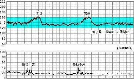怀孕生男孩，胎心率是每分钟多少下怀孕时应注意什么