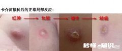 新生儿出生时打的预防针手臂上出现红肿是怎么回事小孩42天了