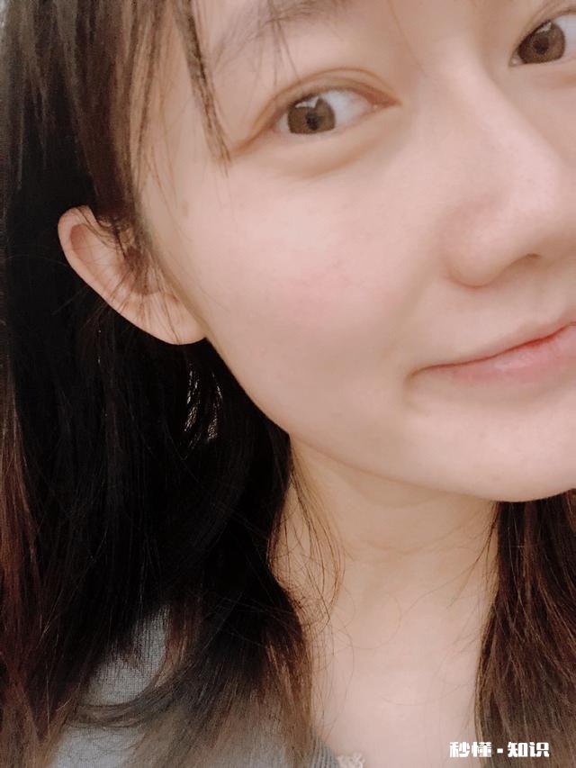 感觉一下子丑了好多，长痘，皮肤粗糙，求孕期好用的护肤品和彩妆