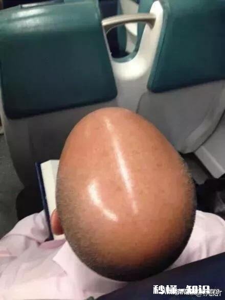 中秋节了，敢不敢晒晒你们那边的月亮