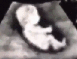 怀孕初期总是睡到半夜就醒，该怎么办