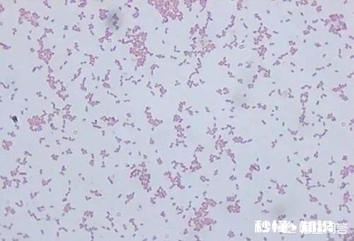 鱼塘每天都死白鲢和鲫鱼十几天，怎么治