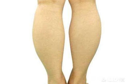 腿部水肿应该怎么办