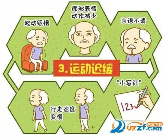 帕金森有哪些明显特征