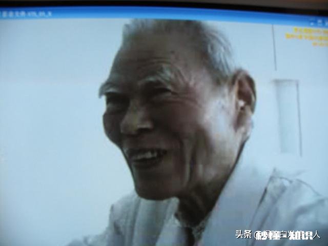 现在越来越多年轻人白发严重是什么原因造成的