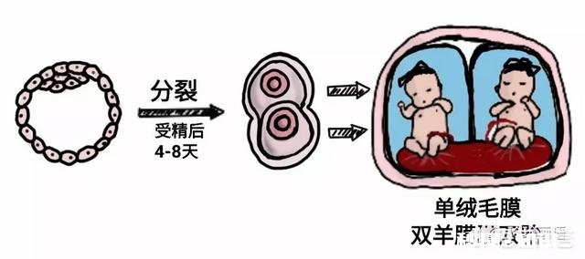 连体婴儿是如何形成的这个遗传吗