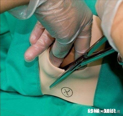 如果婚后老公知道你有流产史!怎么办