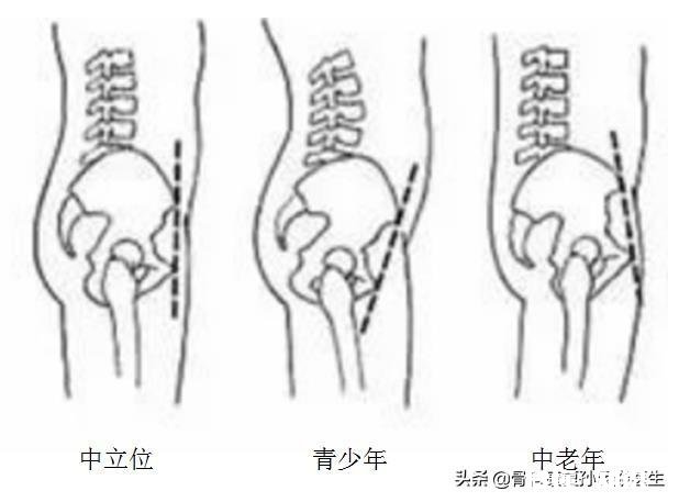 纵欲过度会肾虚，会腰疼这是传统中医的理论。现代医学在这方面的观点、理论是什么