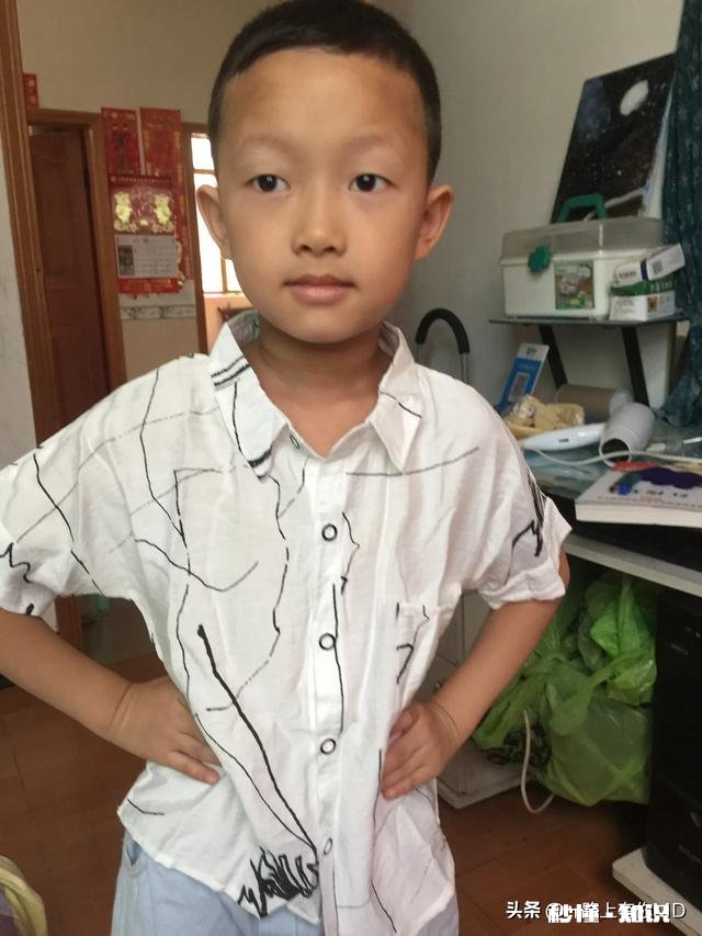 宝宝五个多月了,之前一直是单眼皮,以后有可能会变双眼皮吗