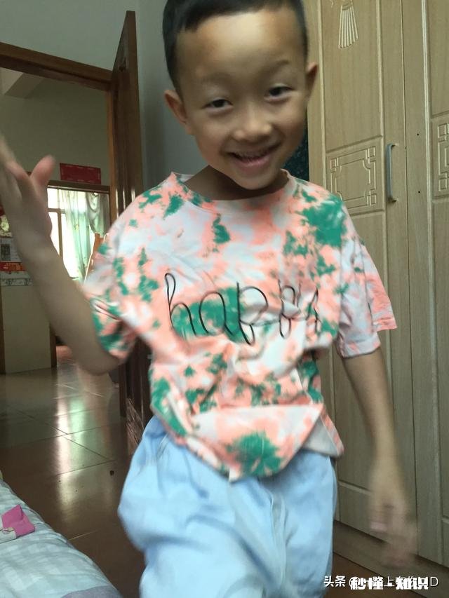 宝宝五个多月了,之前一直是单眼皮,以后有可能会变双眼皮吗